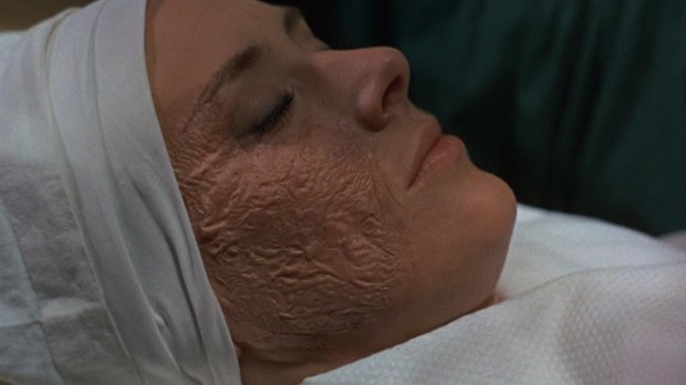 CorruptionDisfigurement